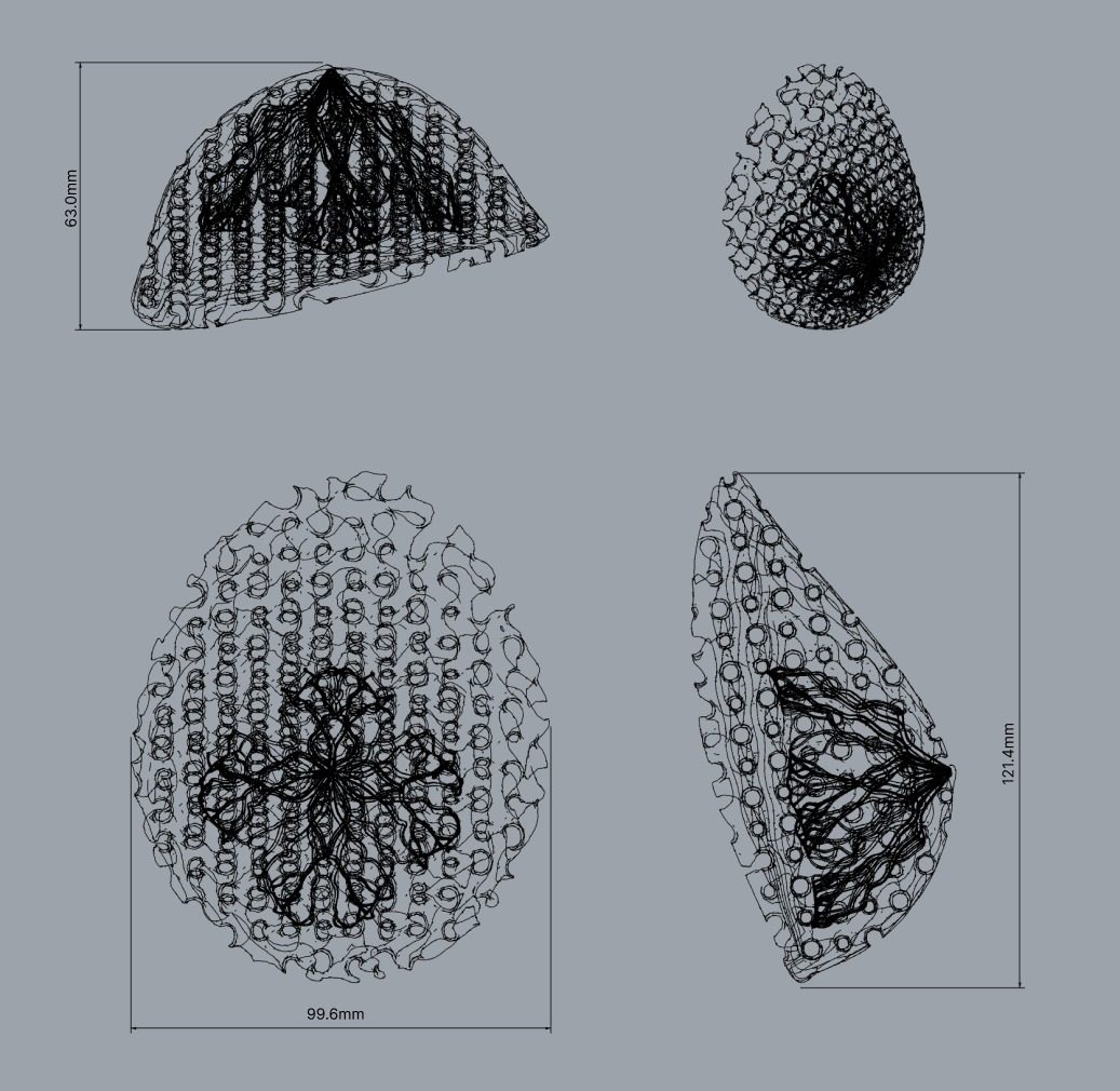 Plan and dimensions of Gÿro prosthesis